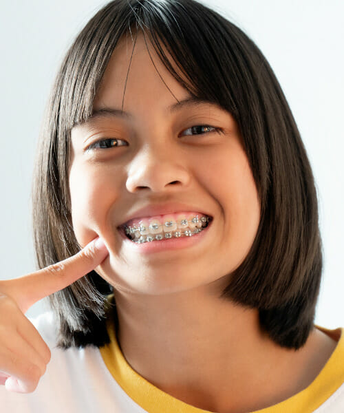 smiling teenager pointing at her new braces
