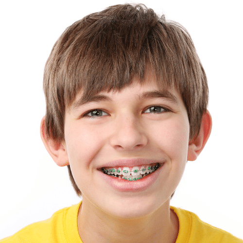 Braces for Kids in Lufkin, TX | Lufkin Kids Dentistry